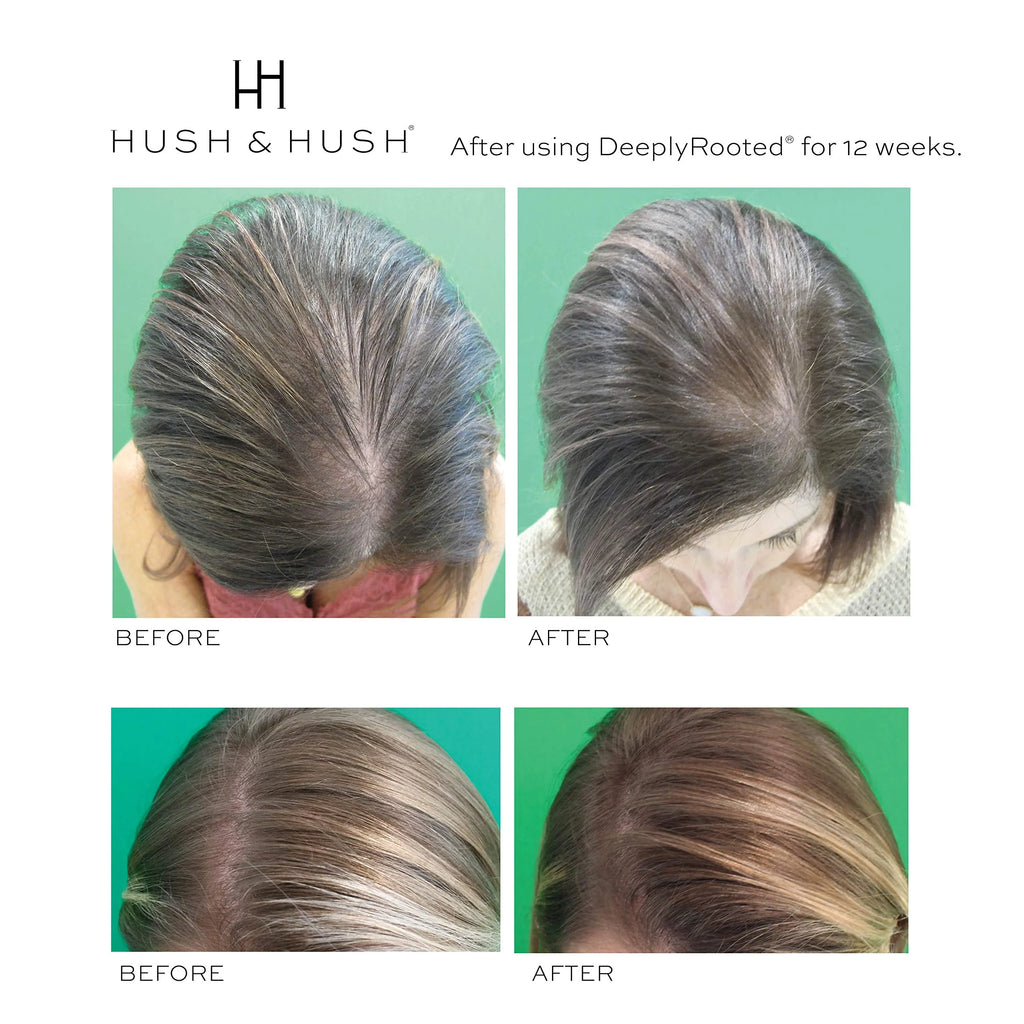 Collagen Biotin Hair Supplement B1283